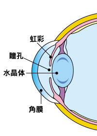 初発白内障