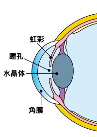 成熟白内障