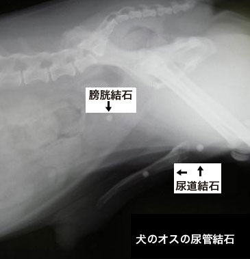 尿管結石レントゲン画像