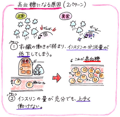 高血圧になる原因について
