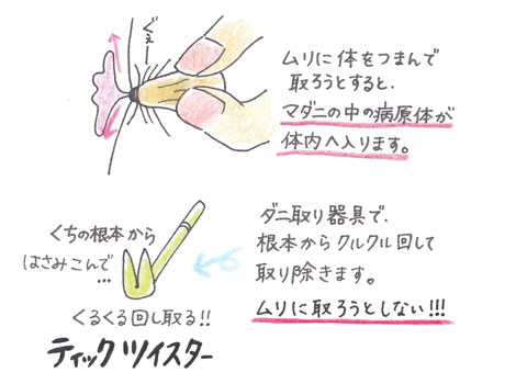 マダニを安全に取るための専用の道具